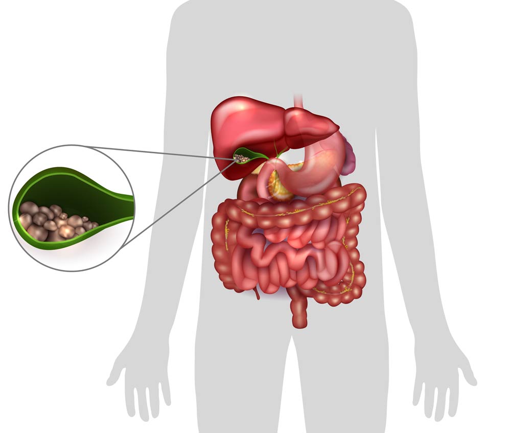 Can a Car Accident Affect Your Gallbladder?